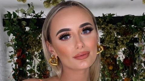 Millie Court opens up about adult acne struggle