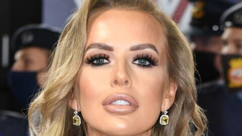 Faye Winter reveals transformation as she gets lip filler dissolved