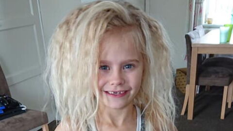 They Called Her 'Troll Doll' - But It Turns Out She Has An Incredibly Rare Syndrome