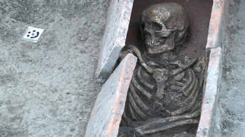 Ancient skeleton with an amputated arm replaced it with an unusual item