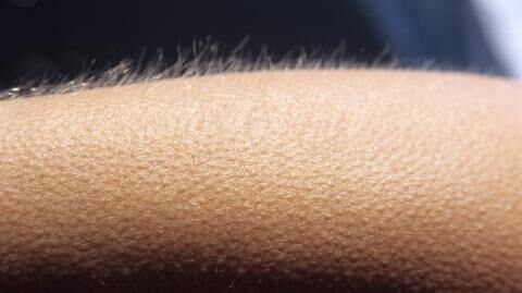 If music gives you chills, your brain is special