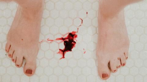 Post-menopausal women and trans men report bleeding after getting jabbed