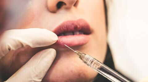 Herpes: Lip fillers can increase your chances of getting nasty cold sores