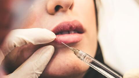 Woman’s infected filler explodes, covering doctor in pus