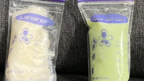 COVID: Breastfeeding mum’s milk turns green after testing positive