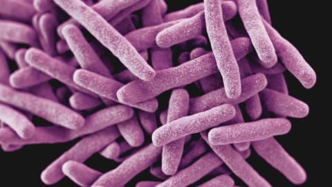 Tuberculosis and COVID: What are the common symptoms and differences?