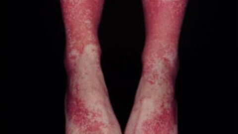 Birth control: Woman suffers this unusual side effect after taking the pill