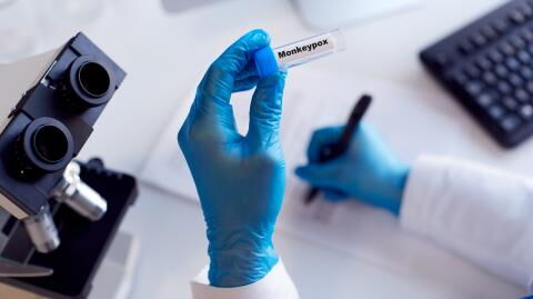 Monkeypox: Who is more likely to be infected with the virus?