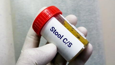 Poo donation: Your poo could help save lives of patients with rare disease - Red Cross