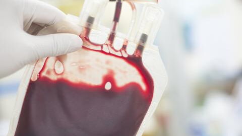 Your blood type could increase your risk of getting a stroke before 60, study shows