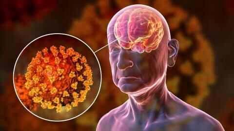 Covid-19: Brain scans show new evidence of what could be causing long Covid