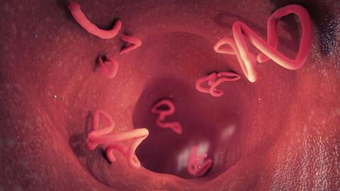 Parasites could be behind your seemingly unexplainable health struggles