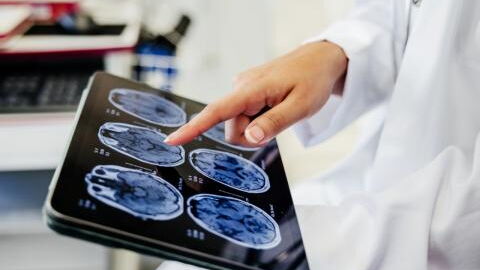 Woman finds out she suffers from an aneurysm after undergoing MRI 'out of curiosity'