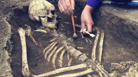 Ancient skeleton with amputated leg may well challenge the history of medicine