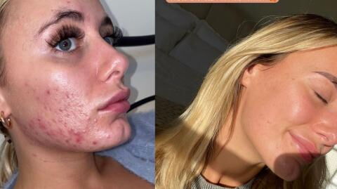 Love Island: Millie shares incredible transformation in new video