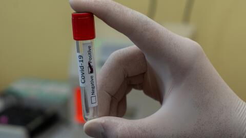 COVID-19: Why is the Omicron variant so contagious?