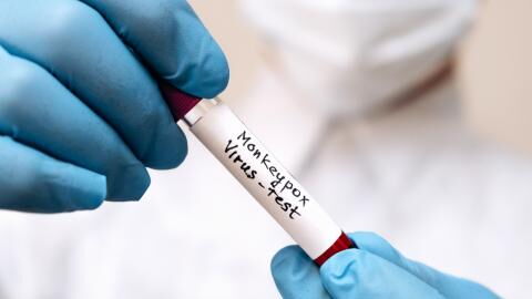 British Airways crew forced to isolate in Singapore due to monkeypox