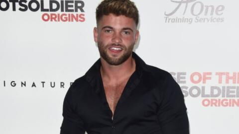 Love Island’s Jake Cornish’s hair transplant gets crazy reactions: ‘Looking like a rip-off wolverine’
