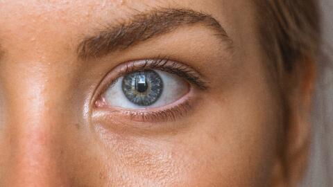 Dark circles: Get rid of undereye bags with these 5 tricks