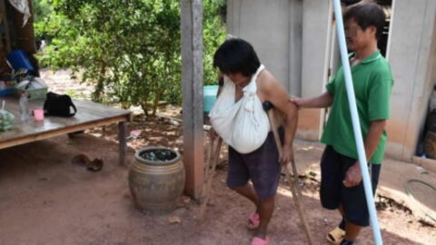 This woman's chest has been growing uncontrollably for over a year