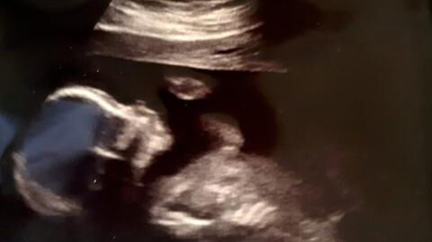 Mum Was Left Stunned When She Gave Birth After Having Prepared For A Baby Girl