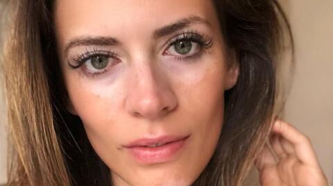 This model covered up her face for 12 years to hide her condition