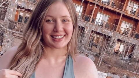 Instagram deleted her picture without an explanation... can you spot why?