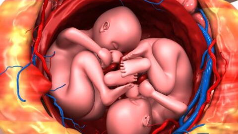 Pregnancy: Woman conceives twice within five days in rare phenomenon