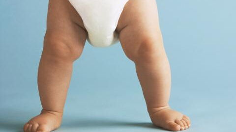 Rare condition causes baby to experience puberty even before she could walk or talk