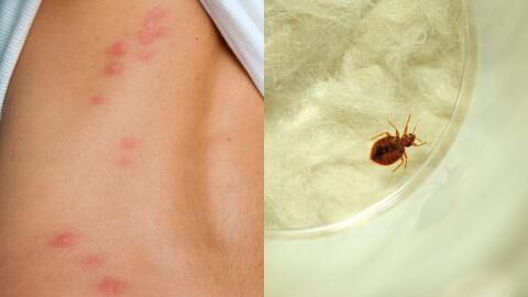 Paris Bed Bug infestation: How to tell the difference between theirs and mosquito bites?