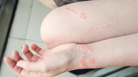 Massive increase of this animal in UK waters, here's what to do if you see one