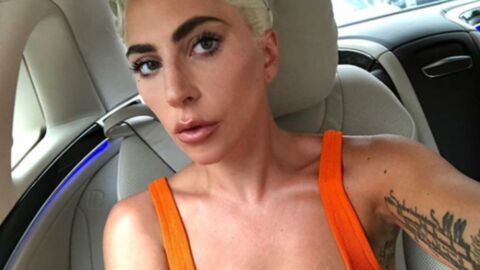 These celebs aren't afraid to show their stretch marks