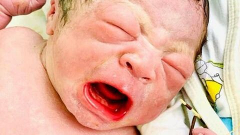 A Baby Was Born Holding a Contraceptive His Mother Had Used Prior to Pregnancy