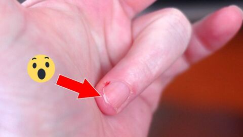 Voici ce qu'il ne faut jamais faire lorsqu'on casse son ongle !