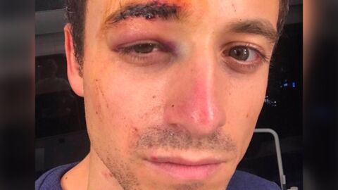 Gilets jaunes : le journaliste Hugo Clément blessé au visage lors de la manifestation