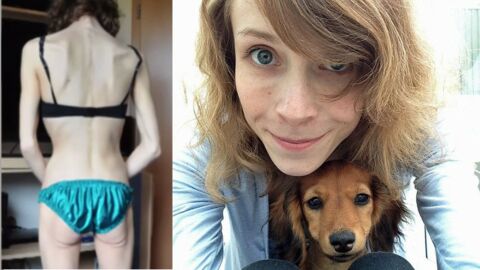 Une étudiante anorexique guérit de sa maladie... Grâce à son chien ! 