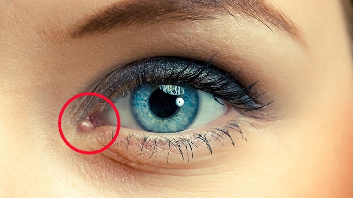 Voici ce que signifie ce petit angle rose au coin de votre oeil