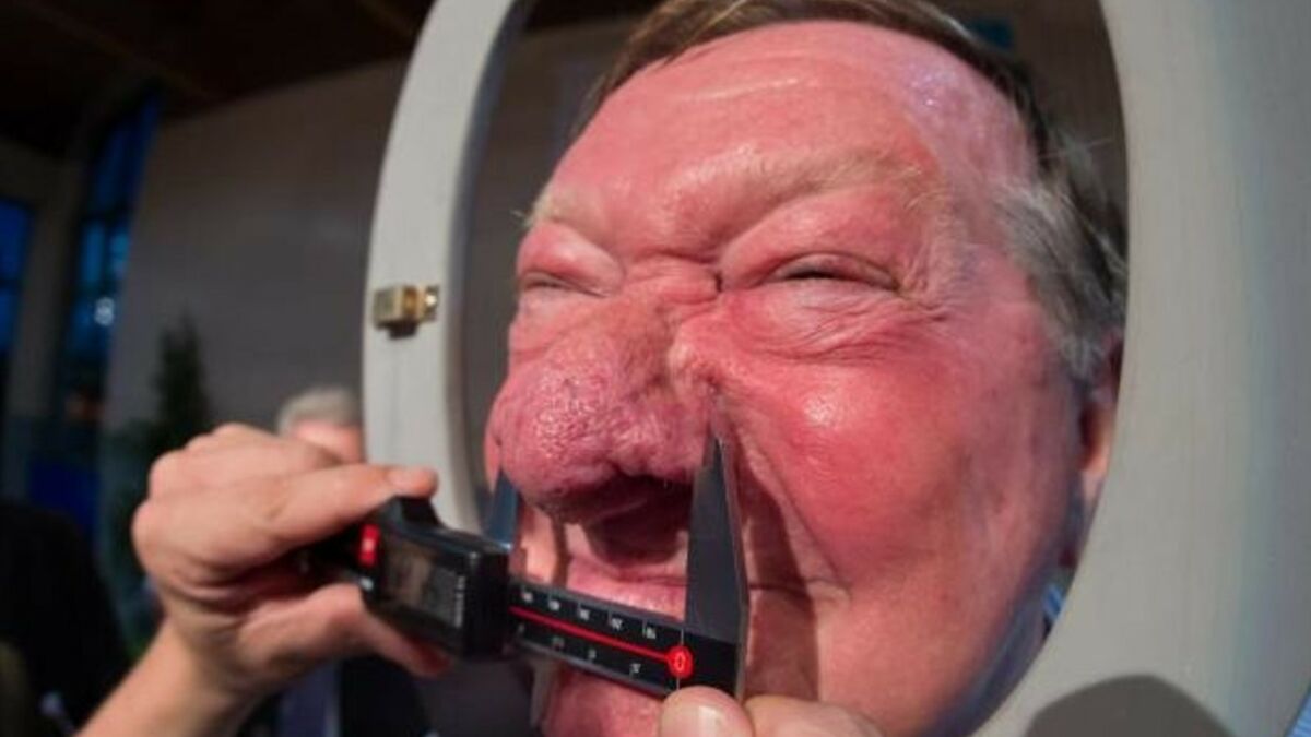 Championnat du monde du plus gros nez : le plus gros nez du monde mesure  près de 66 millimètres de longueur