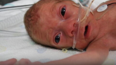Ce Petit Bebe Est Ne Au Bout De 27 Semaines De Grossesse Seulement 4 Ans Plus