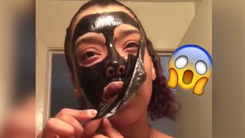 Elle pose un masque au charbon sur son visage pour lutter contre les points noirs et n'arrive plus à l'enlever