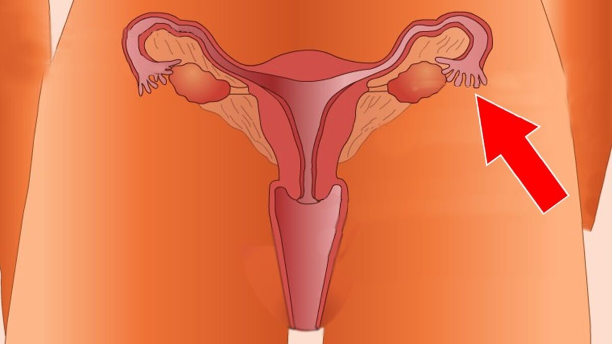 Règles douloureuses : en quoi consiste le congé menstruel que l