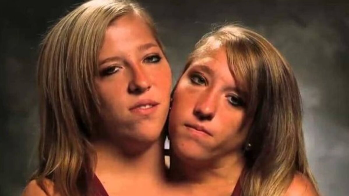 Les Soeurs Siamoises Abigail Et Brittany Enceinte