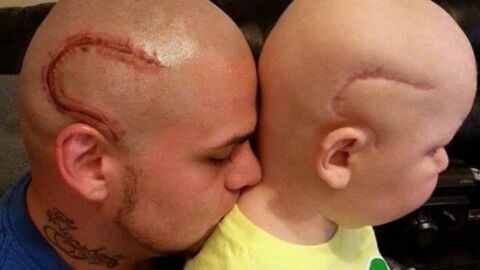 Il se fait tatouer la même cicatrice que son fils atteint d'un cancer