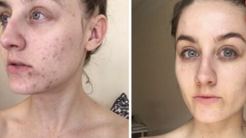 Cette femme arrête de se laver le visage pendant 6 mois et fait une étonnante découverte