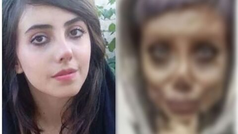 Elle a succombé à la chirurgie pour ressembler à Angelina Jolie, elle ressemble à un Zombie
