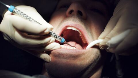 Inde : un adolescent se fait retirer 82 dents lors d'une opération