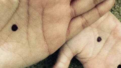 Connaissez-vous la signification de ce point noir sur la main ?