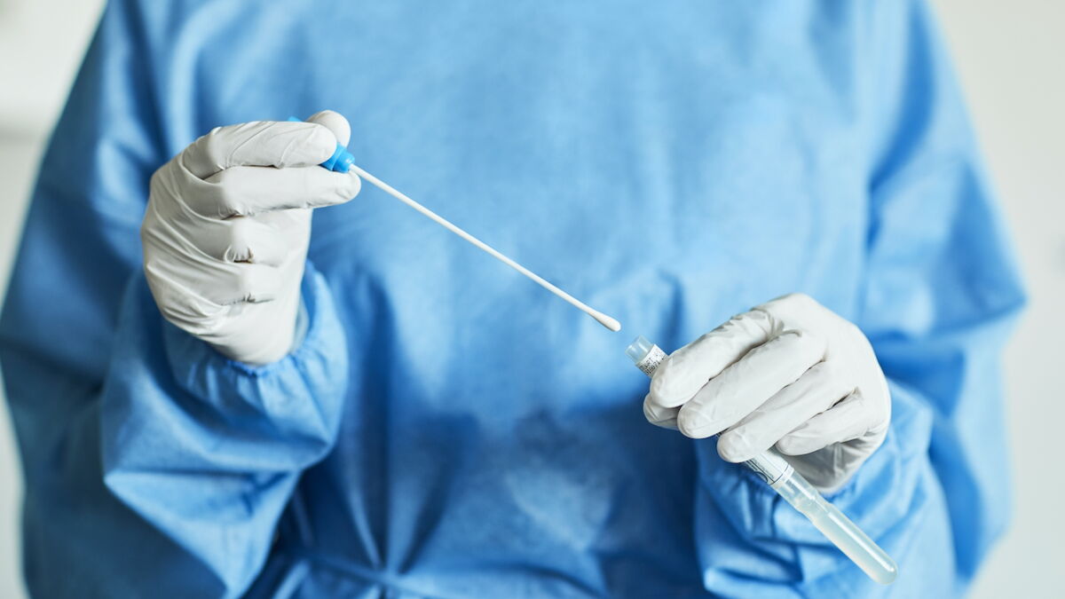 Covid19 quel est le coût des tests PCR et antigéniques, pays par