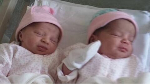 Diese Zwillinge sind mit unterschiedlicher Hautfarbe zur Welt gekommen