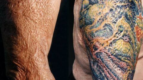 Cover-Up-Tattoos: Narben überstechen und verdecken